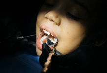 Belang van een goede tandarts voor uw mondzorg *