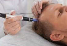 Waarom kiezen voor lokale haarklinieken in plaats van goedkope opties in het buitenland? *